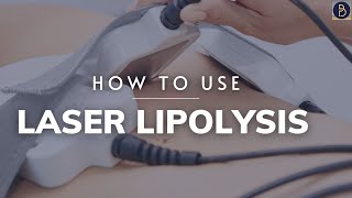 How to use Laser Lipolysis bodysculpting [upl. by Sletten]