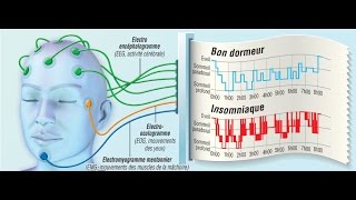 Troubles du sommeil et polysomnographie [upl. by Drexler]