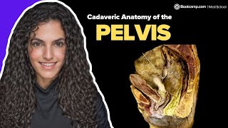 Anatomy of the Pelvis  Can you identify this structure  Med School Bootcamp [upl. by Dabbs]