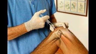 COMO INFILTRAR OZONO EN RODILLA PARA DESIMFLAMAR [upl. by Yenor430]