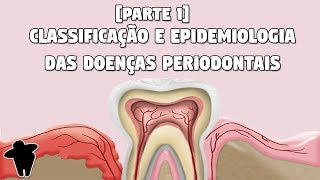 Classificação e Epidemiologia das Doenças Periodontais  Concursos Para Dentistas DE 6 PT1 [upl. by Winnah]