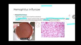 2 Hemophilus Influenzae  Must 201 [upl. by Eenimod]