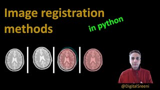 120  Image registration methods in python [upl. by Turmel]