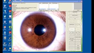 Digital Iridology Analyzer Eye Iriscope Iridology Camera Analyzer Disease Diagnosis Machine [upl. by Stavro252]