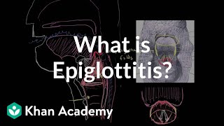 What is epiglottitis  Respiratory system diseases  NCLEXRN  Khan Academy [upl. by Stark669]