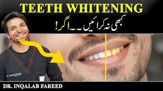 Never Get Teeth Whitening Treatment if  Urdu  Hindi  InqalabFareed [upl. by Terrilyn]