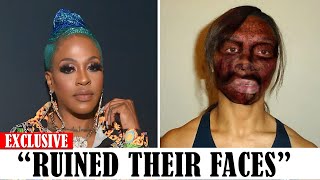 20 Black celebrities Who RUINED Their Careers With PLASTIC SURGERY [upl. by Earased683]