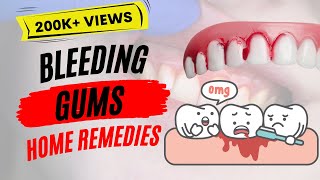 Bleedings Gums  Causes amp Best Home Remedies [upl. by Yorztif]