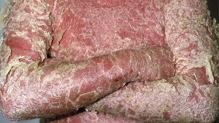 Erythrodermic psoriasis images photos pictures erythroderma symptoms [upl. by Serra]