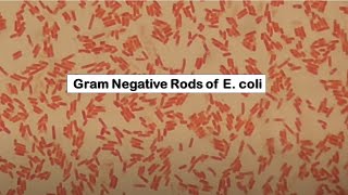 E coli in Gram staining [upl. by Ztnaj]