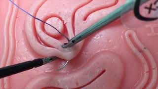 18102MUL Laparoscopic Intracorporeal Suturing Fundamentals and Tips amp Tricks for New Learners [upl. by Chitkara]