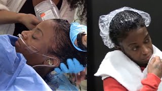 Gorilla Glue Girl — Full Surgery Video Removing Glue From The Head [upl. by Afihtan]