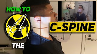 HOW TO XRAY the CSPINE  cervical  odontoid  fuchs  swimmers  positioning  radiology program [upl. by Akinas85]