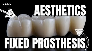 The SHOCKING truth about prosthetic aesthetics revealed Lesson 4 [upl. by Allis]