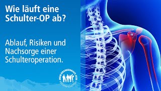 Schulter OP Ablauf Risiken und Nachsorge einer Schulteroperation  Marcel Ziegler Ltd Oberarzt [upl. by Atiniuq]