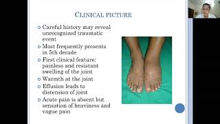 Neuropathic Joints1 Class by Kakatkar Sir JOINTS PG Teaching Initiative [upl. by Alli]