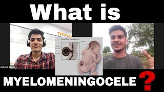 What is Myelomeningocele Watch Full Story of Patient  Ashishsharmavlogsofficial spinalcord [upl. by Kristopher41]