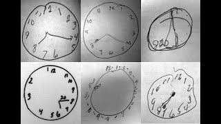 NEUROPSICOLOGIA  TESTE DO DESENHO DO RELÓGIO EM IDOSOS COM DECLÍNIO COGNITIVO  Aula de Laboratório [upl. by Lerrad]