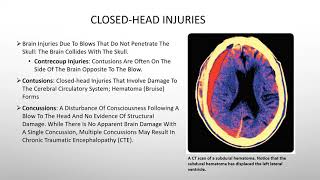 BiopsychologyBrain Damage And Recovery [upl. by Lindahl]