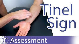 Tinel Sign Wrist  Carpal Tunnel Syndrome Diagnosis [upl. by Amice]