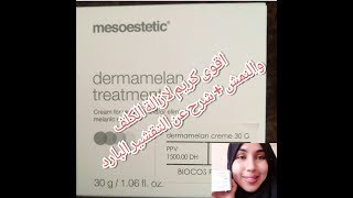 شرح اقوى كريم لعلاج الكلف و النمش شرح التفشير بالبارد dermamelan treatment [upl. by Ive178]