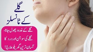 Tonsils ka gharelu ilaj  Tonsillitis treatment in urdu  Galay ke tonsils ka ilaj [upl. by Allehcram]