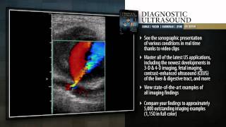 Diagnostic Ultrasound 4th Edition [upl. by Annadal635]