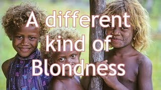 A different kind of Blondness  Melanesians and TYRP1 [upl. by Primaveria]