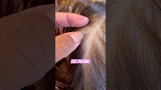 Lice picking l lice removal l small business hair lice shorts hairvideo [upl. by Mackenzie]