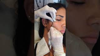 Colocando um piercing Microdermal no rosto [upl. by Uhn957]