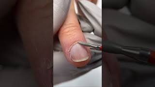 How to remove overgrown cuticles shorts [upl. by Schreibe]