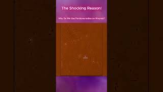 Why Do We Use PovidoneIodine on Wounds [upl. by Diver]