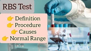 RBS Test  Random blood sugar test  Procedure [upl. by Lexa450]