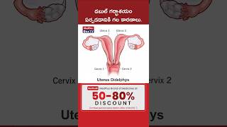 Double uterus  Symptoms and causes l Dr B Radhika shorts MedPlusONETV [upl. by Yerhpmuh]