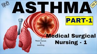 Asthma  Bronchial Asthma In Hindi  Types Etiology Risk factor amp PathoPhysiology  PART1 [upl. by Anilys991]