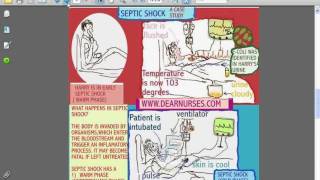 SESSIONS for NURSES 10  CARDIOGENIC AND SEPTIC SHOCK [upl. by Jeannine790]