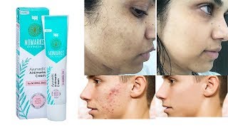 New Bajaj Nomarks Cream For Normal Combination Oily Skin Review Uses Benefits  Side Effects [upl. by Jarrid104]