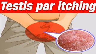 Testis par itching Scrotal itching ka treatment [upl. by Ashley880]