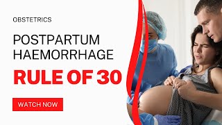 Rule of 30  Postpartum Haemorrhage  Mnemonic  Obstetric Made Easy [upl. by Ennahteb492]