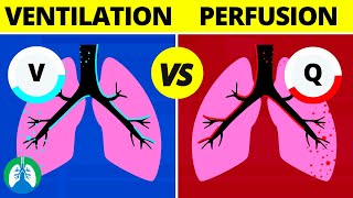 VentilationPerfusion VQ Ratio  Quick Medical Overview [upl. by Lekar]