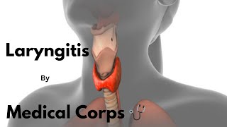 Laryngitis General OPD TopicsMedical Corps 🩺 [upl. by Carla915]