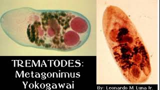 TREMATODES Metagonimus Yokogawai  Leonardo M Luna Jr [upl. by Ikey606]