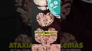 Minamata ¡El Desastre Tóxico Japonés curiosidades sabiasque historia medicina ciencia shorts [upl. by Sug]