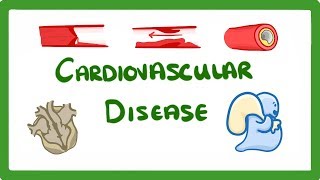 Understanding Cardiovascular Disease Visual Explanation for Students [upl. by Leeda]