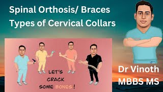 Spinal Orthosis Cervical Collar  TLSO Brace  Back pain Braces NEET PG NExT orthopaedics [upl. by Rina947]