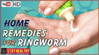 9 Home Remedies For Ringworm In Humans [upl. by Ahseekal]