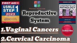 Usmle step 1Vaginal tumorsCervical carcinoma from PathomaReproductive system pathologyUrduHindi [upl. by Samaria253]