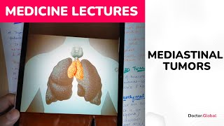 Mediastinal tumors Everything you need to know [upl. by Eluk]