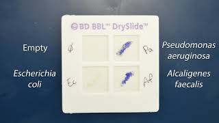 Demo Biochemical Tests  Oxidase Test [upl. by Herbert]