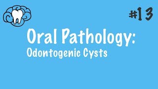 Oral Pathology  Odontogenic Cysts  INBDE ADAT [upl. by Gnal731]